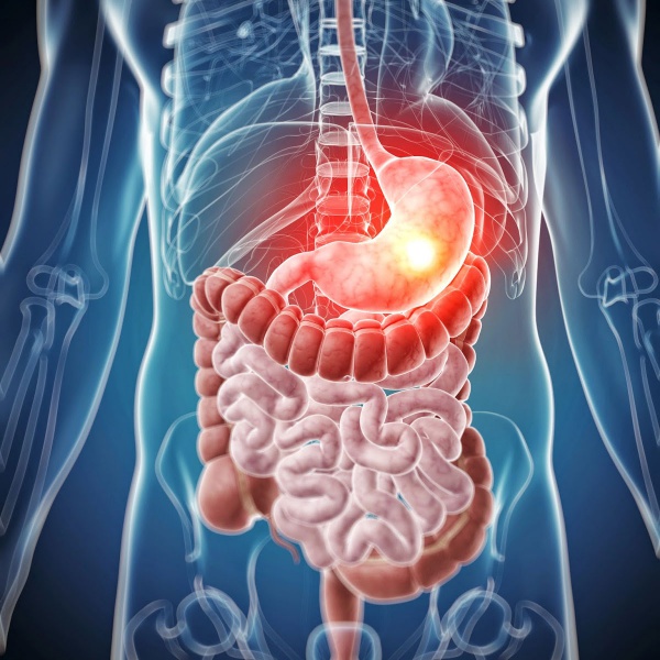 A new concept of microbiome problem and gastrointestinal diseases